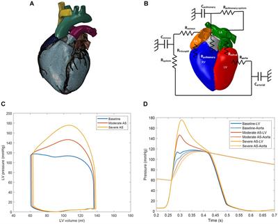 Impact of Aortic Stenosis on Myofiber Stress: Translational Application of Left Ventricle-Aortic Coupling Simulation